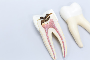 endodontics-image